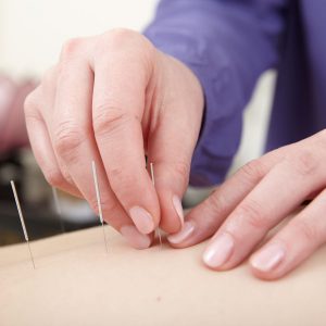 Katharine inserting needles