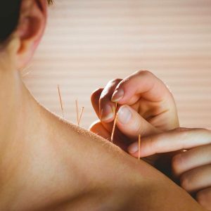 what is acupuncture