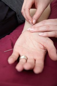 Acupuncture on the wrist