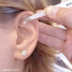 Car appointments feature ear seed therapy